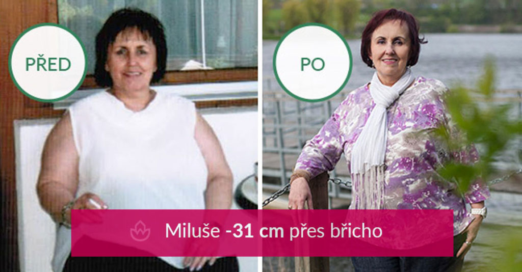 Směje se paní Miluše Jarešová, která dokázala během 14 měsíců bez hladu odložit závaží o 25 kg a zeštíhlet přes břicho o 31 cm. Jediné, co ji teď trápí, je výměna šatníku o 2 až 3 konfekční velikosti menší oblečení.